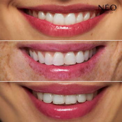 Magický olej na rty Magický olej na rty